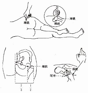 還跳穴|環跳:別名,名稱釋義,功能作用,治法,定位,解剖,主治,操作,臨床運用,。